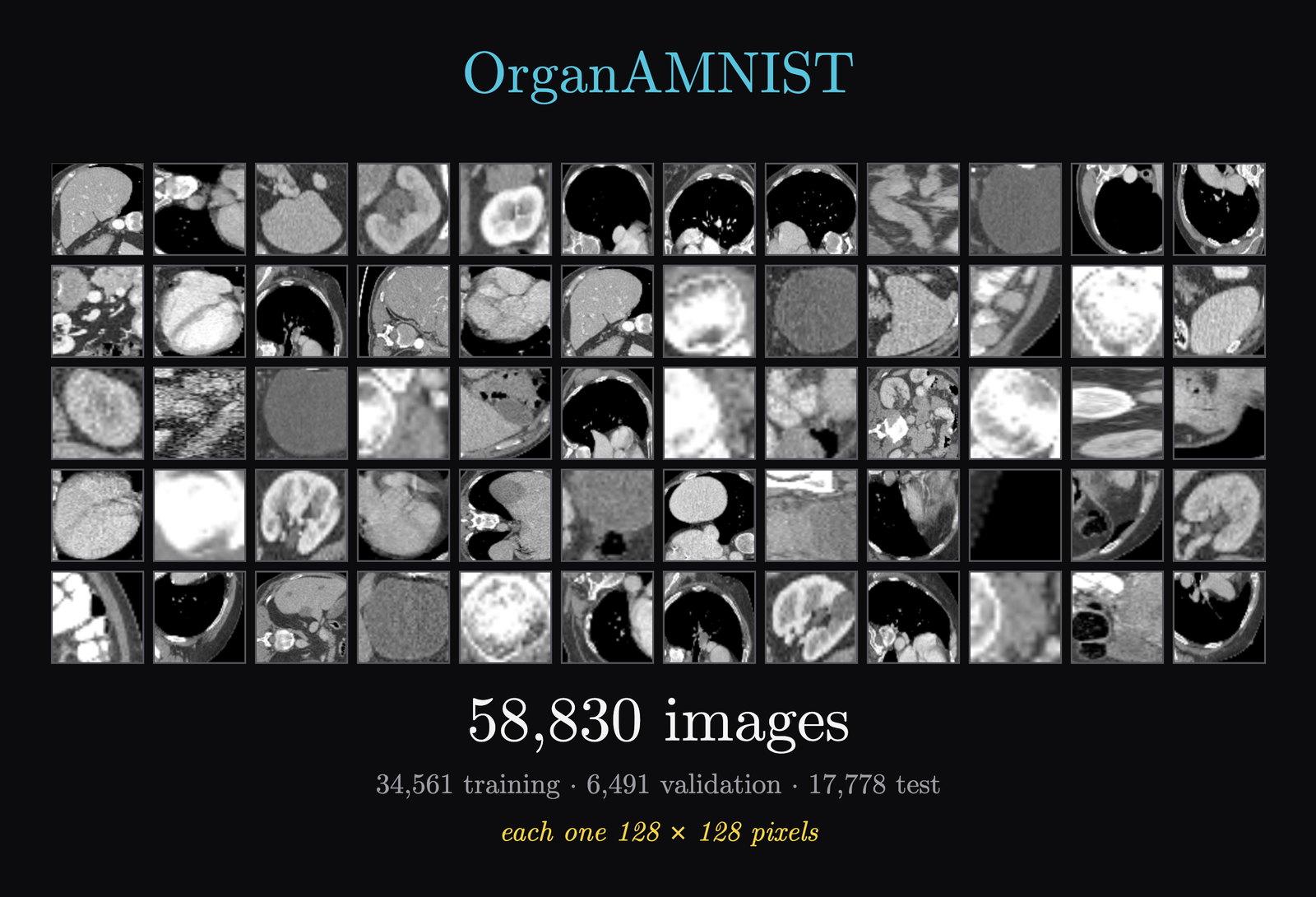 A grid of real OrganAMNIST crops