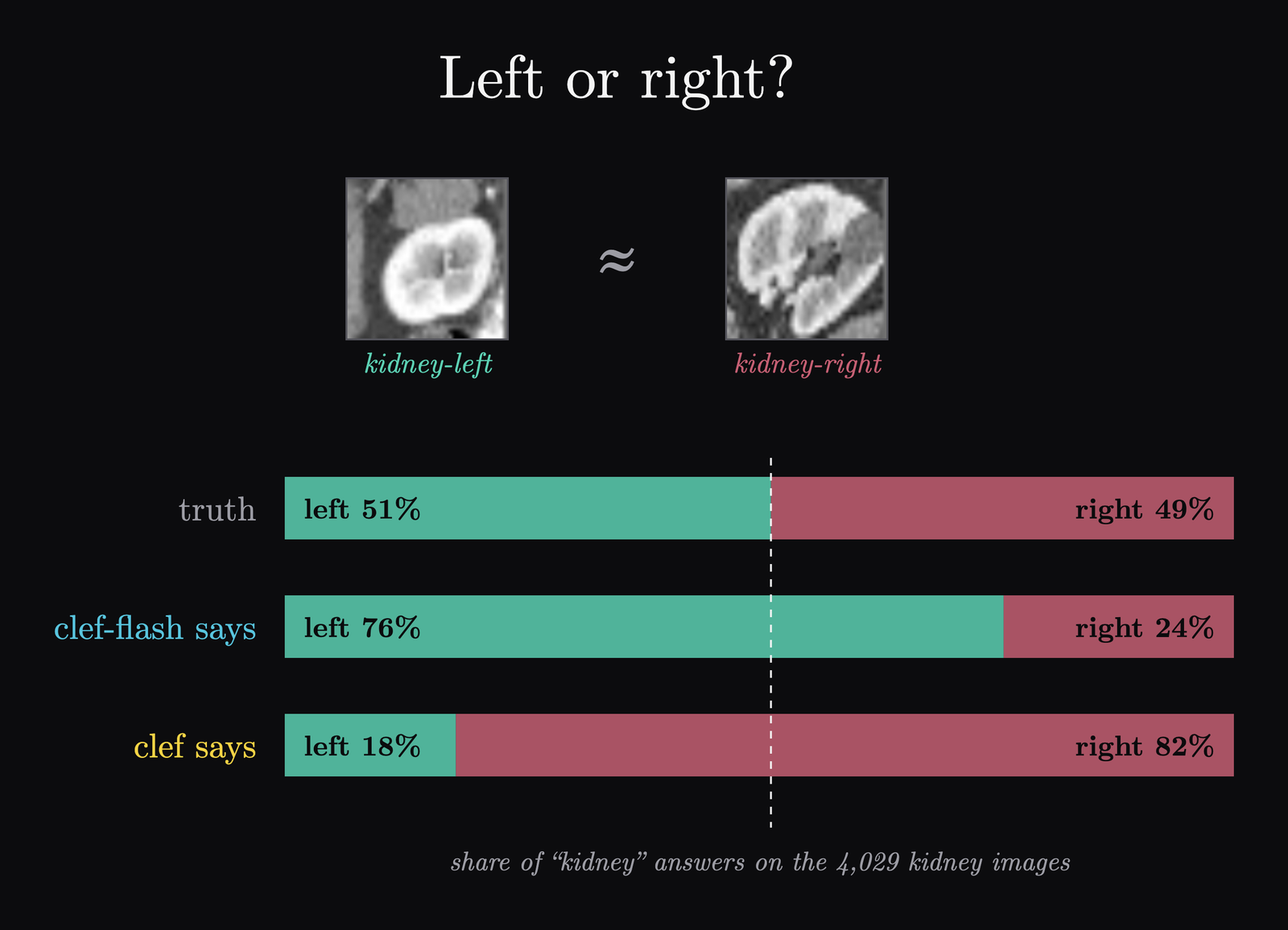 Share of left and right answers on the kidney images